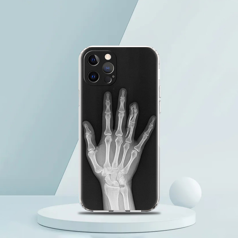 Transparent Phone Case Cover f - Phone Cases That Fit Iphone 16E review and price